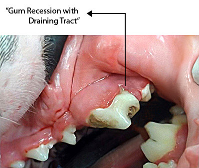 gum recession details