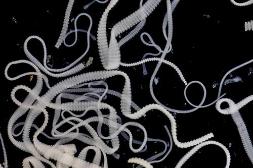 Tapeworm infection by ingesting food