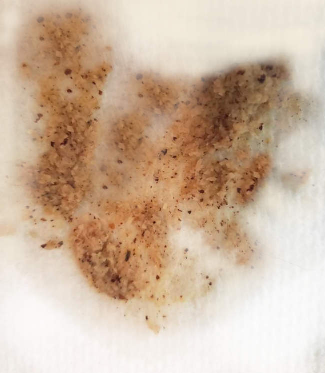 Pictures of Dog Vomit with Blood, Explained By a Veterinarian