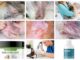 collage of rash images around the groin and veterinarian pictures