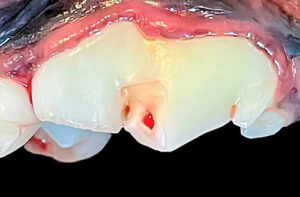 Pictures of Tooth Abscesses in Dogs, with Details From our Veterinarian