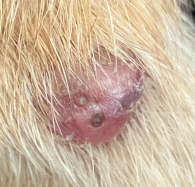 Cyst that is ulcerated and bruised with a possible mild bacterial infection