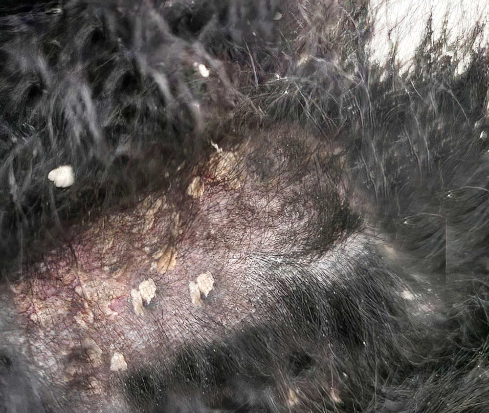 what is walking dandruff on dogs