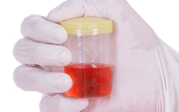 red color in dog urine sample