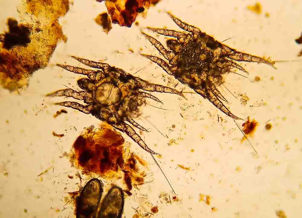 ear mites in microscope