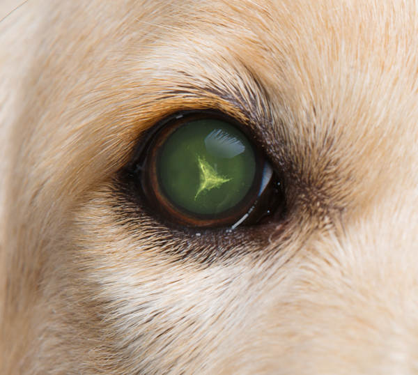 Posterior polar Y-suture cataract in a retriever