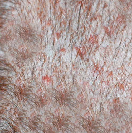 folliculitis on dog skin - closeup image