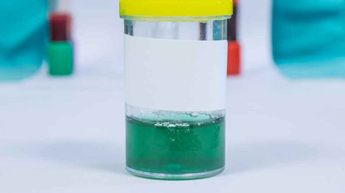 green urine sample in a laboratory