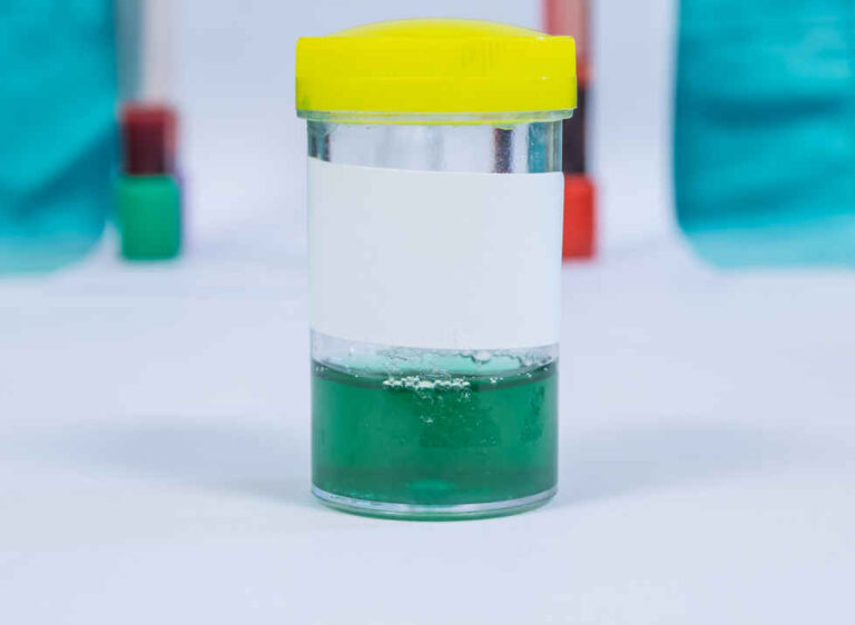 Green Dog Urine: What Does it Mean & What Should I do?