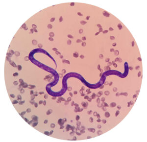 What is My Dog’s Life Expectancy After Heartworm Treatment? A Vet Weighs In