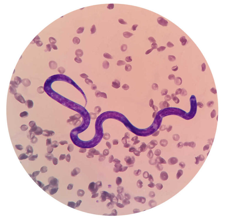 What is My Dog’s Life Expectancy After Heartworm Treatment? A Vet Weighs In