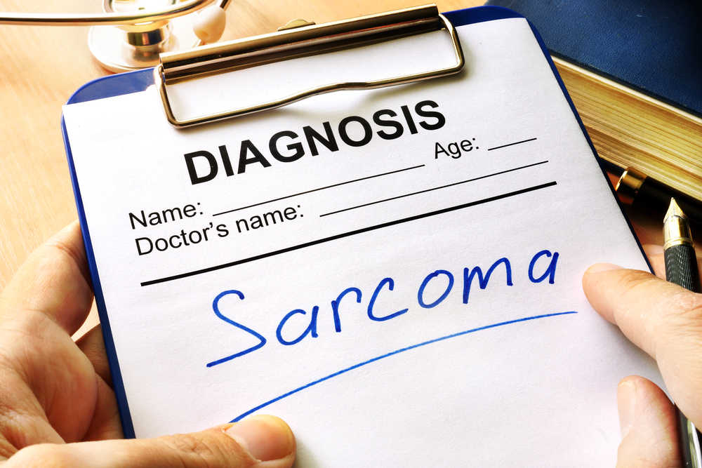 sarcoma diagnosis