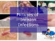 collage of dog incision infection pictures