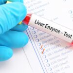 Elevated Liver Enzymes in Dogs: FAQ with Our Vet