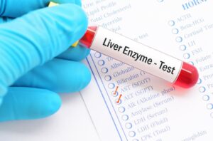 Elevated Liver Enzymes in Dogs: FAQ with Our Vet