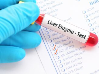 liver enzyme test with sample and checklist