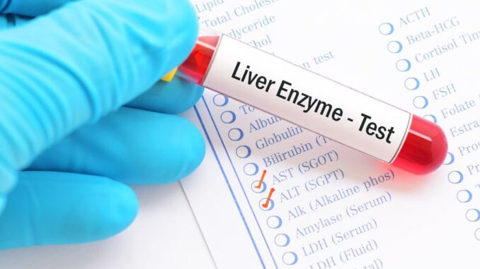 liver enzyme test with sample and checklist