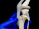 luxating patella and knee overview