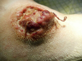 open mast cell tumor on a dog