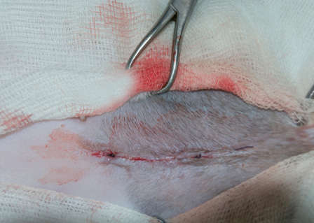incision immediately after surgery, with slightly pink skin and edges touching each other