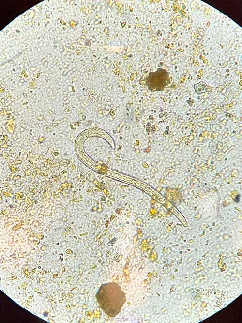 hookworms under microscope
