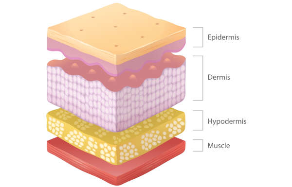 illustration showing the layers of skin of a dog