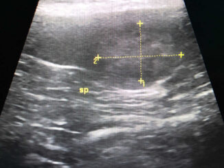 ultrasound showing possible dog splenic tumor