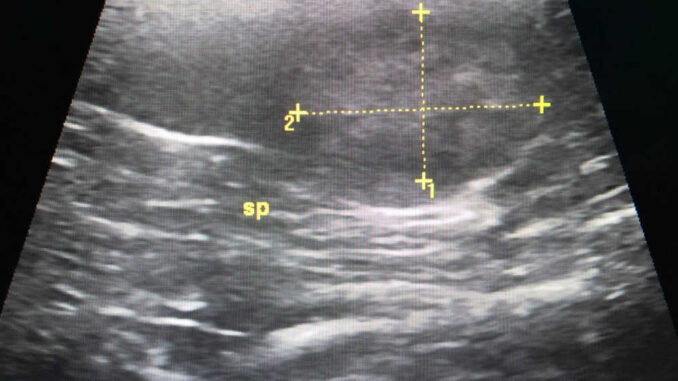 ultrasound showing possible dog splenic tumor