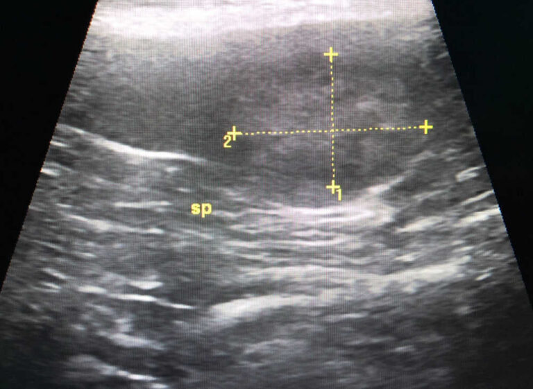 What is My Dog’s Life Expectancy With Splenic Tumor? A Vet Explains