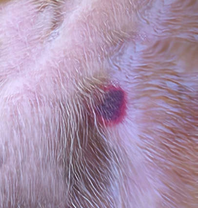 tick bite with dark red bullseye around a black bruise in the center