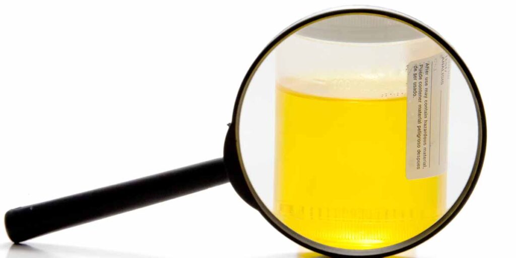 urine sample