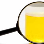 urine sample analysis