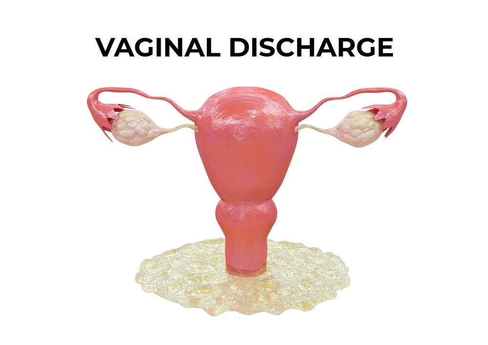 clear vaginal discharge illustration