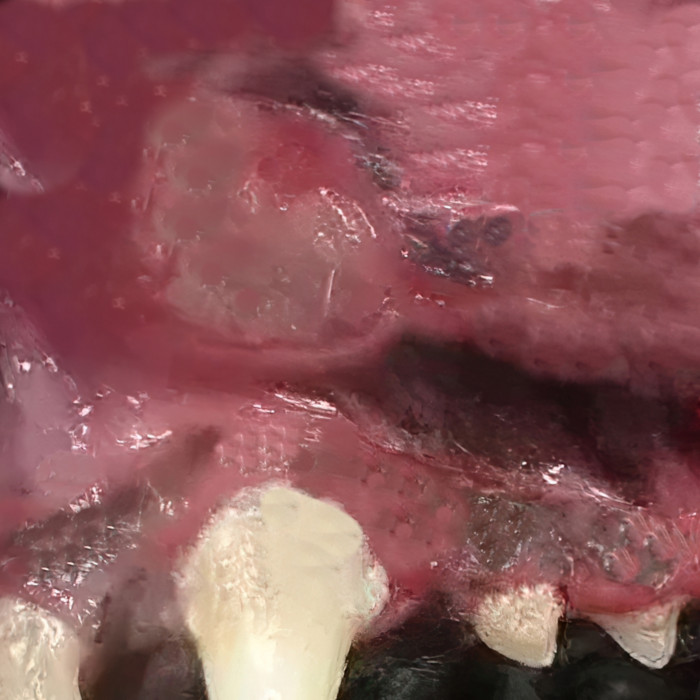 mouth sore with a small area of discolored tissue