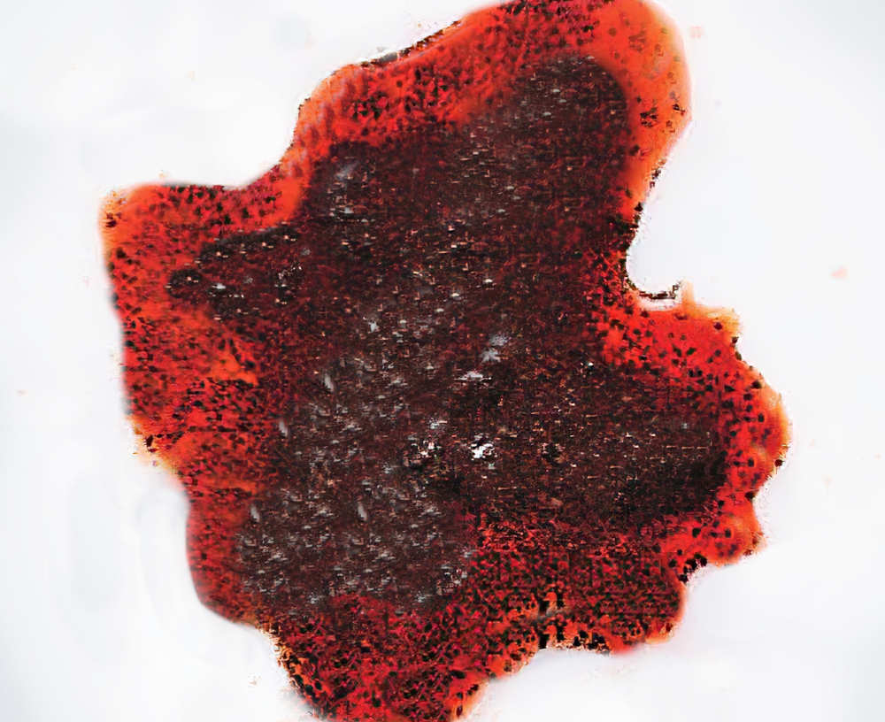 coffee ground appearance of blood in dog's' vomit