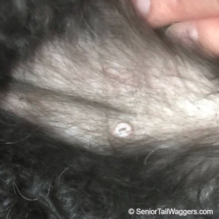 cyst looks like a round and elevated pale white bump that is smooth and has a small area of black pigment