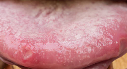 closeup showing bumps due to inflammation on a dog's tongue